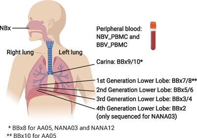 B Cell Mobilization, Dissemination, Fine Tuning of Local Antigen Specificity and Isotype Selection in Asthma